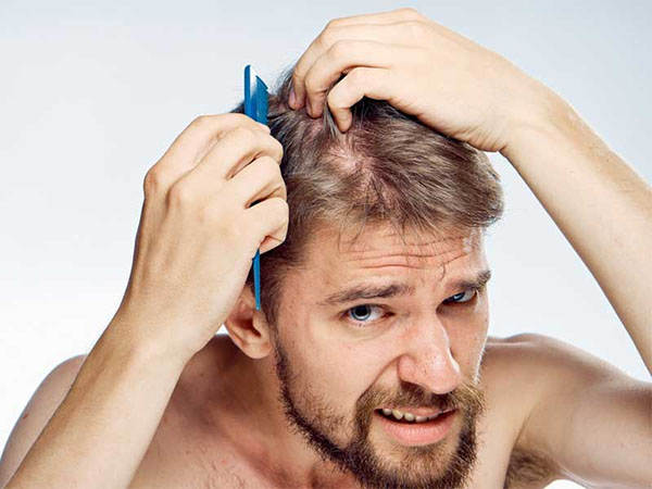 Chăm sóc tóc cho nam giới và những sai lầm thường mắc phải