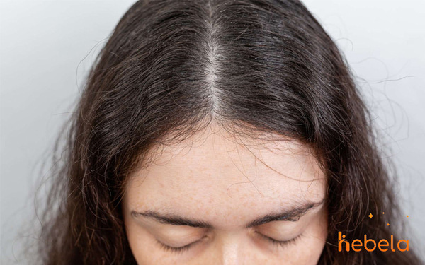 Mái tóc rễ tre luôn là một vấn đề mà nhiều người gặp phải. Hãy cùng nhau khám phá các kiểu tóc phù hợp với mái tóc rễ tre để tạo nên một vẻ ngoài thật xinh đẹp và thu hút.
