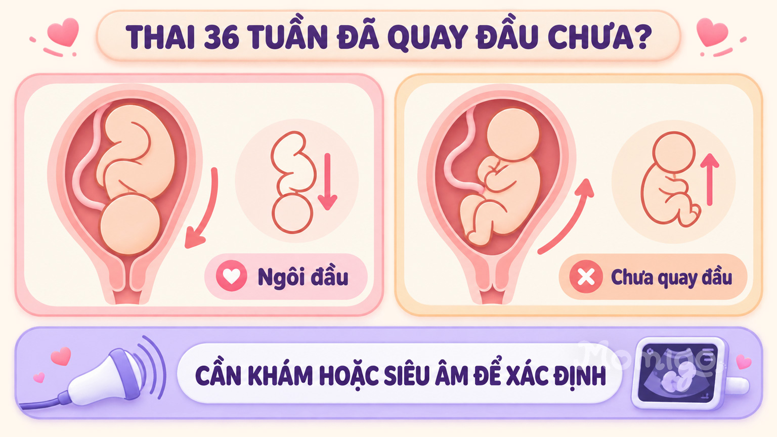 Bác sĩ có thể khám hoặc siêu âm để xác định ngôi thai
