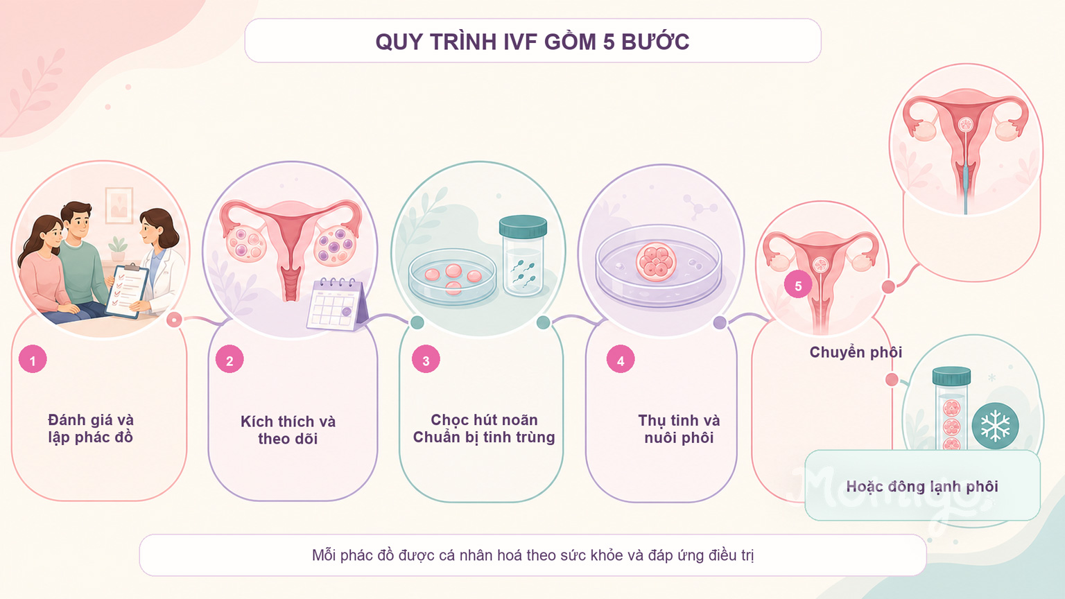 Tổng quan quy trình IVF gồm 5 bước