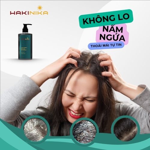 Dầu Gội Giảm Gàu, Dầu Gội Trị Gàu Hakinika 330ml – Giảm Gàu, Ngứa Da Đầu, Kiểm Soát Dầu Nhờn, Sạch Gàu, Làm Dịu Da Đầu